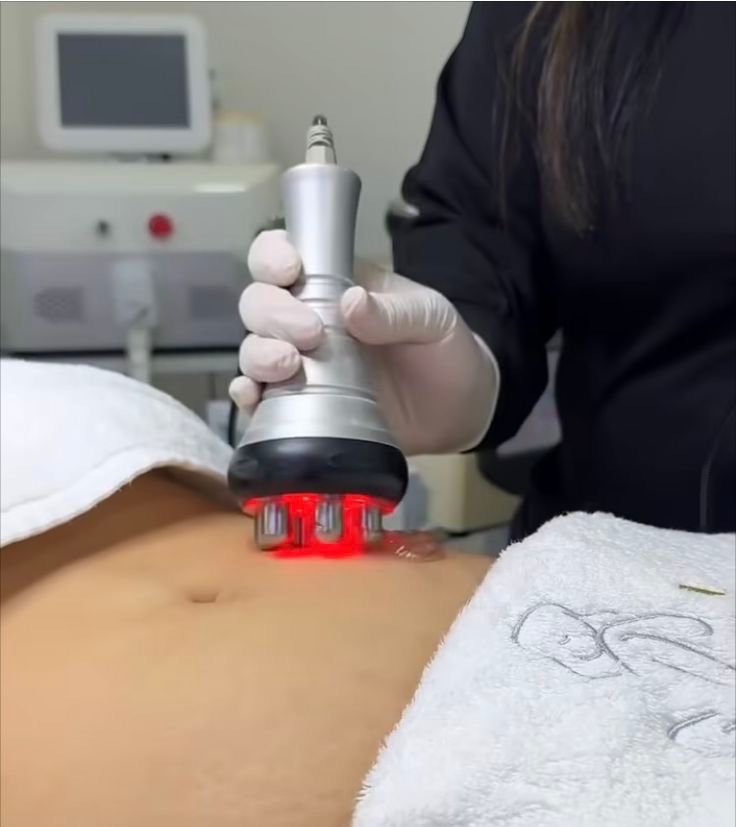 Body Contouring 4