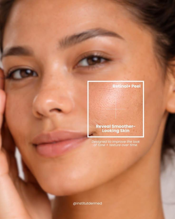 Retinol Peel-Lunch Time Peel