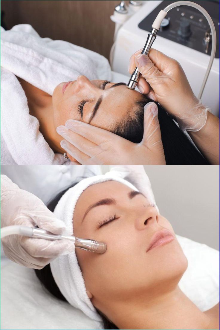 Dermabrasion Facial