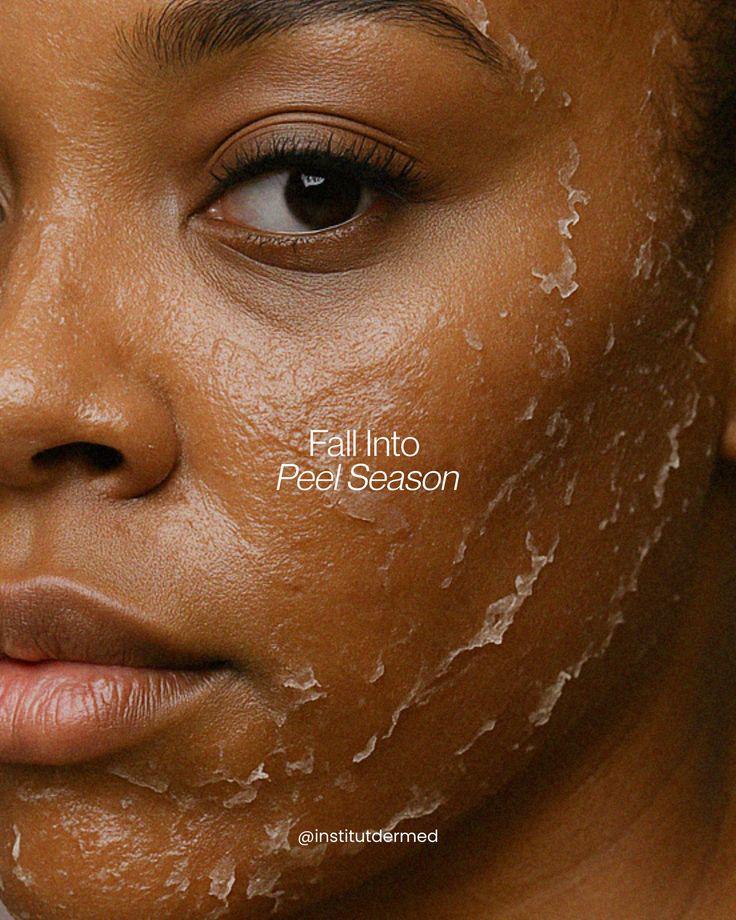 Lactic Peel-Party Peel