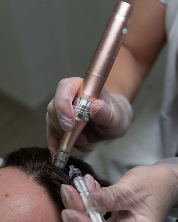 Scalp Regeneration Therapy